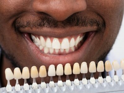 Are Dental Implants Worth It