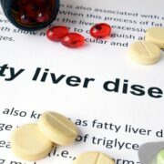 Various Medication For Fatty Liver