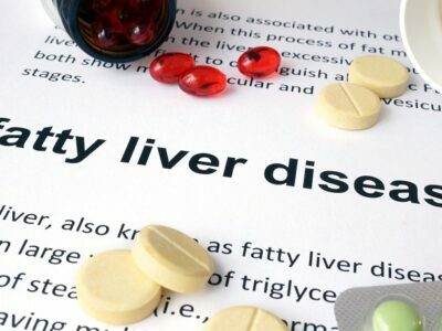 Various Medication For Fatty Liver