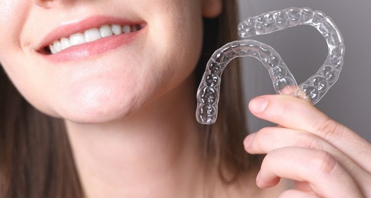 Clear Aligners