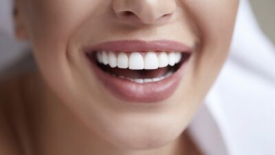 Dental Cosmetic