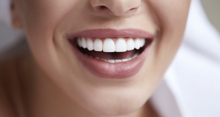 Dental Cosmetic