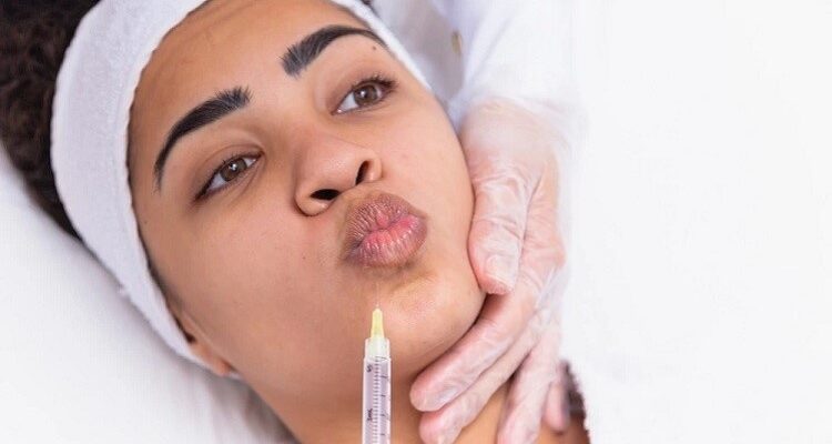 Best Lip Laser Treatment Kottayam for Fine Lines Lip Laser
